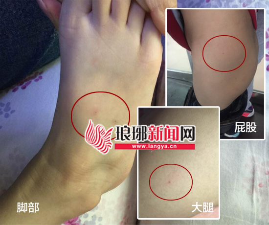 孩子幼儿园内被针扎双方各执一词警方已介入
